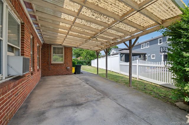 1026 W Broadway, Woodmere, NY 11598